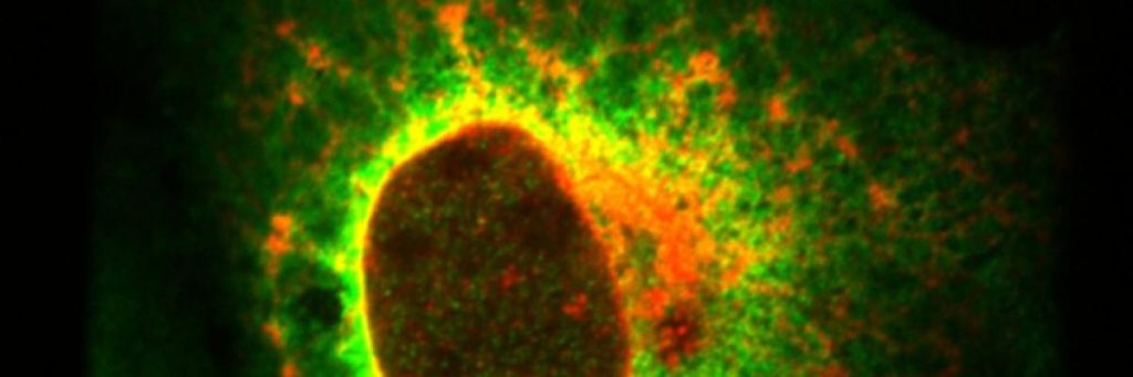 Image credit: NCI, Ewa Krawczyk