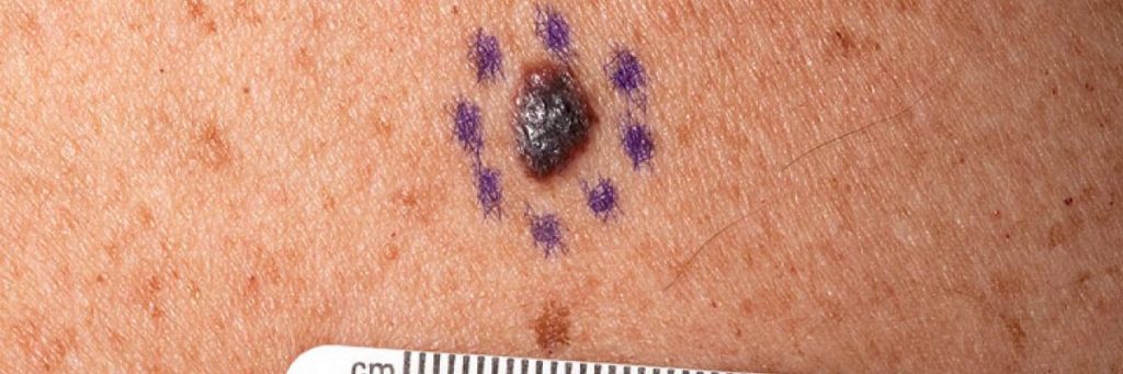 Credit: National Cancer Institute