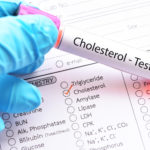 cholesterol test