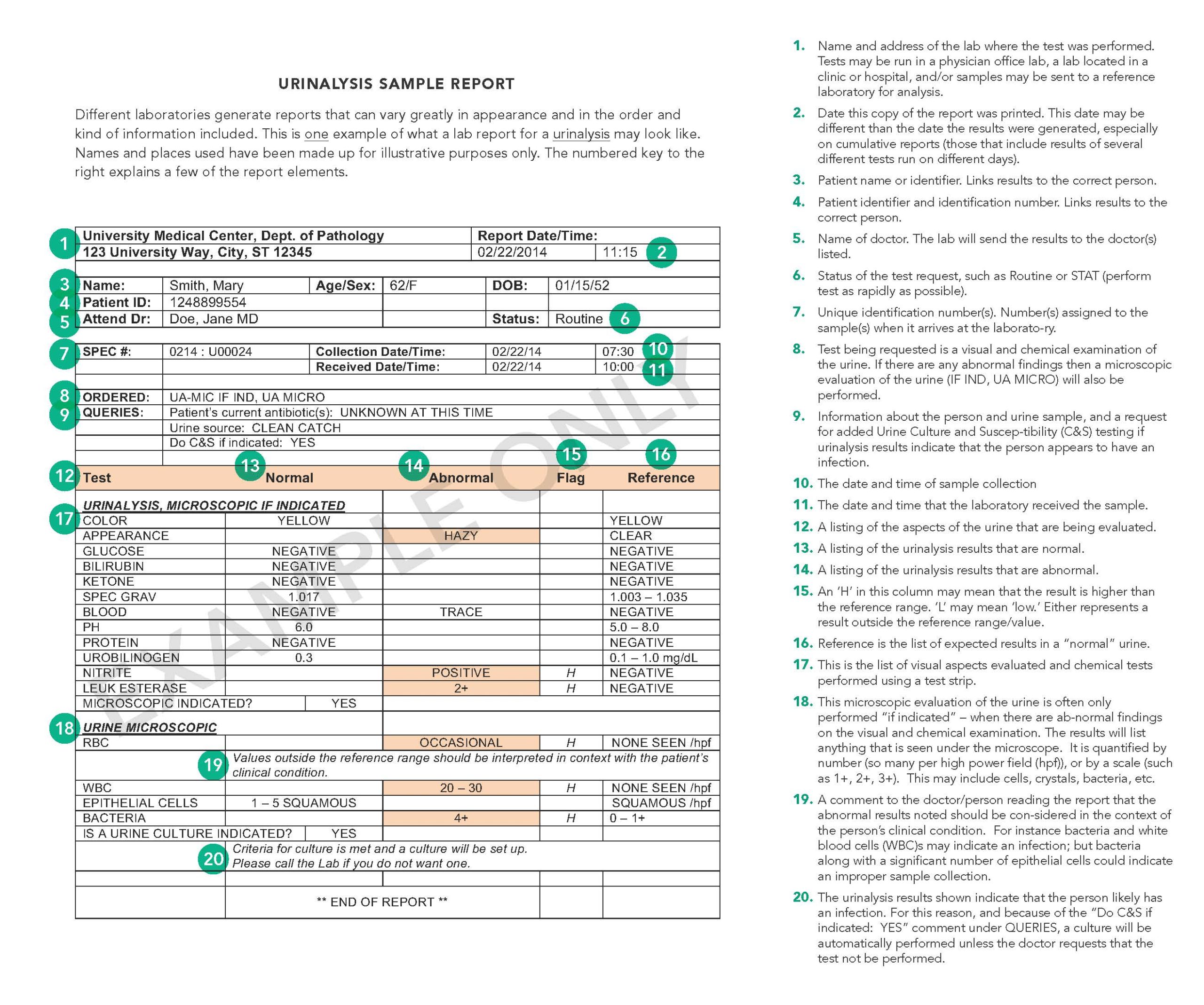 Image of sample Urinalysis Report