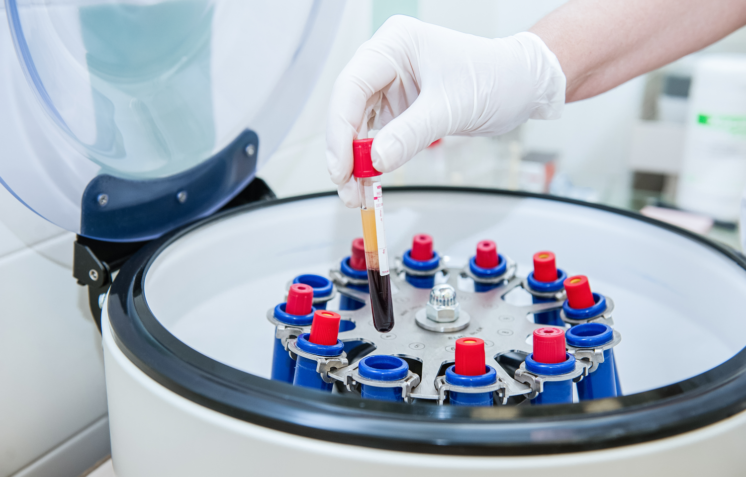 Processing blood samples